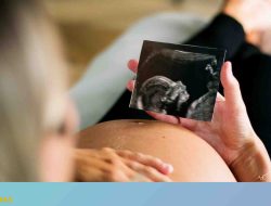 7 Are Avocados Good for Pregnant Women